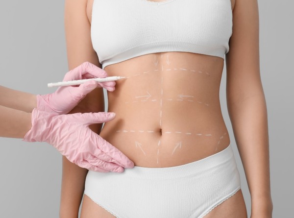 As Áreas do Corpo Onde a Lipoaspiração é Mais Eficiente: Descubra a Sua